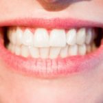 Przepiękny uśmiech zapewniają zdrowe zęby